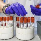 Imagen de archivo de personal técnico de laboratorio preparando unas muestras para analizar.