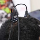 Detalle de una sesión del ensayo clínico en el cerebro de un hombre que sufría tetraplejia.