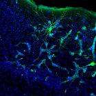Metástasis en cerebro de ratón. Se aprecia cómo la metástasis (verde más claro) interacciona con una neurona (verde más intenso). Esta neurona está marcada específicamente para su estudio, pero la metástasis está interaccionando con muchas más.