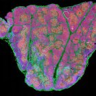 Sección de tejido completo de un timo humano después del nacimiento, que muestra timocitos (rojo), células epiteliales (cian) y células madre junto a zonas de fibronectina (verde).