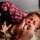 La vacunación de poliomielitis en niños