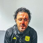 Hirieron en la cabeza al técnico visitante, el italiano Fabio Grosso.