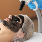 Existen un sinnúmero de tratamientos faciales en el mercado. Estos son los mejores para lucirte en estas fiestas.