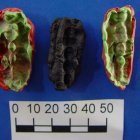 Las caries y las enfermedades de las encías ya acuciaban al hombre hace 10.000 años