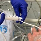 Proceso. Después de la sedación, el paciente podría sentir ciertos mareos