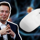 El dispositivo de Neuralink, llamado Telepathy, tiene como objetivo permitir a las personas controlar diversos dispositivos