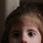 Ana Paula Vera sufre el síndrome de Moebius.