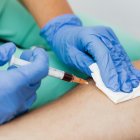 Aporte. El voluntario aporta en el tratamiento de pacientes oncológicos.