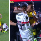 Joao Rojas sufrió una fractura de tibia.