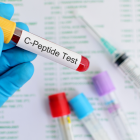 Referencial. Una de las áreas más prometedoras de la investigación del TB-500 reside en su posible implicación en la cicatrización de heridas