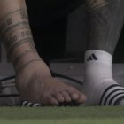 El tobillo de Lionel Messi hinchado, no se sabe cuando volverá a jugar.