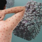 Reconocer los síntomas y buscar atención médica de manera oportuna es crucial para controlar la propagación del virus