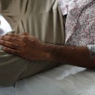 Un paciente es atendido tras ser diagnosticado con mpox.