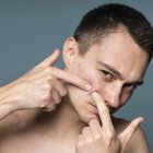 Antes de extraer los puntos negros hay que retirar el exceso de grasa con un limpiador.