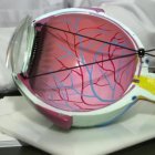 El síndrome de ojo seco puede causar lesiones en la superficie ocular que podrían dañar la córnea.