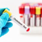 Descubre qué niveles de colesterol deberías tener según tu edad.