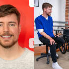 El empresario regaló 50 prótesis en Ecuador