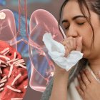 Grafico referente a tuberculosis