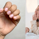 Un hábito común como morderse las uñas puede traer problemas de salud a las personas