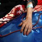 Detalle del brazo de una mujer mientras se somete a un proceso de diálisis.