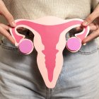 El cáncer de ovario es una enfermedad compleja con muchos mitos que dificultan su comprensión