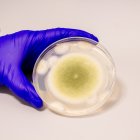 Una muestra de Aspergillus flavus cultivada en el laboratorio Gao.