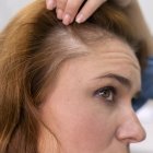 Es posible que el fin de la alopecia esté cerca
