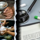 Convocatoria para compra de equipos del proyecto Ecuador Libre de Desnutrición