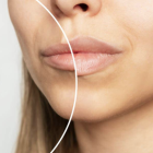 Los biopolímeros fueron aplicados durante años en procedimientos estéticos sin regulación clara. Hoy, su retiro se convierte en una necesidad médica urgente para cientos de mujeres.