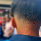 Herida del agente municipal afectado.