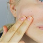 Las enfermedades de la piel afectan a personas de todas las edades.