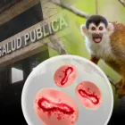 Viruela del mono mantiene en alerta al sistema de salud pública