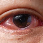 El CMNV deja el océano y entra en la salud humana.