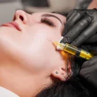 El plasma rico en plaquetas se ha convertido en uno de los tratamientos estéticos más buscados por su efecto regenerativo y revitalizante en la piel del rostro.
