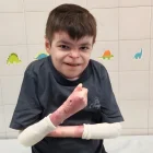 Leo, de 12 años, inicia en Sevilla la terapia génica Vyjuvek para tratar la Piel de Mariposa.