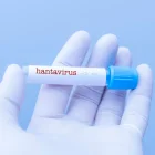 Muestra etiquetada como hantavirus en laboratorio, en medio de la alerta sanitaria internacional por posibles brotes.