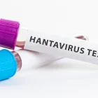 Referencial. Muestras de laboratorio utilizadas en pruebas para detectar hantavirus.