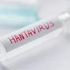 Autoridades sanitarias investigan posibles contagios de hantavirus ligados al crucero neerlandés Hondius.