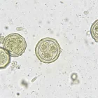 Oocistos de Cryptosporidium, parásito responsable de brotes de diarrea en EE. UU.